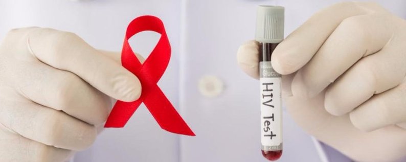 Протягом року на диспансерний облік в області заноситься близько 400 ВІЛ-позитивних 