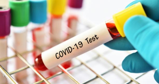 В області виявили 104 нові випадки захворювання на COVID-19