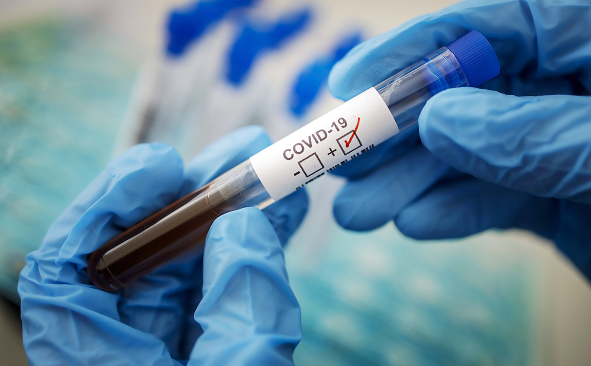 За добу на Полтавщині виявили 343 нових випадків захворювання на COVID-19
