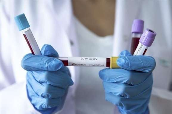За добу на Полтавщині виявили 1 407 нових випадків захворювання на COVID-19