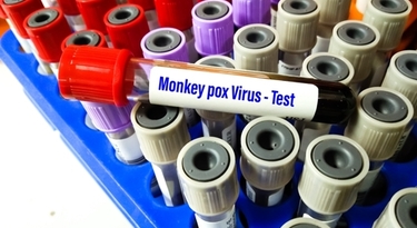 Що варто знати про вірус мавпячої віспи
