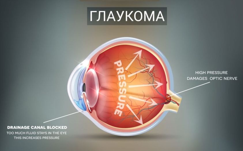 11-17 березня – Всесвітній тиждень боротьби з глаукомою